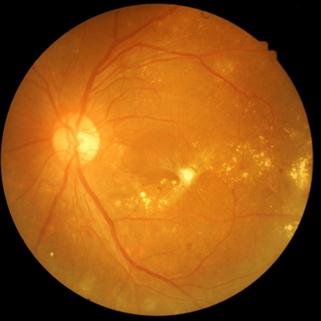 Ihr Brillengeschäft & Augenoptiker in Eschwege OttO Visuelles